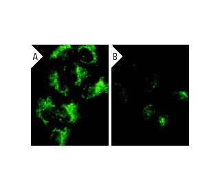 Bad siRNA (h): sc-29778. Immunofluorescence staining of methanol-fixed, control HeLa (A) and Bad siRNA silenced HeLa (B) c 
