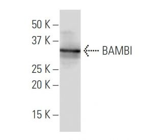 BAMBI Antibody (3B7) - Western Blotting - Image 34053Each CRISPR/Cas9 Knockout (KO) Plasmid product consists of a pool of 3 plasmids designed to ensure identification and cleavage of a specific gene for maximum knockout efficiency. Each plasmid encodes a unique 20 nt sequence derived from the GeCKO (v2) library.