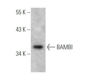 BAMBI Antibody (3B7) - Western Blotting - Image 367980Each CRISPR/Cas9 Knockout (KO) Plasmid product consists of a pool of 3 plasmids designed to ensure identification and cleavage of a specific gene for maximum knockout efficiency. Each plasmid encodes a unique 20 nt sequence derived from the GeCKO (v2) library.