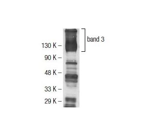 band 3 Antibody (BIII 136) - Western Blotting - Image 137494