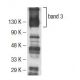 band 3 Antibody (BIII 136) - Western Blotting - Image 137494