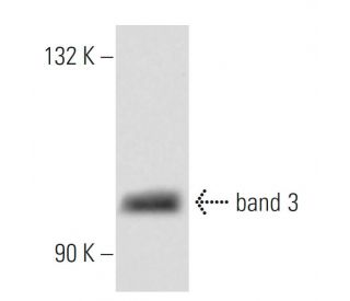 band 3 Antibody (Q1/156) - Western Blotting - Image 12674