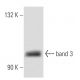 band 3 Antibody (Q1/156) - Western Blotting - Image 12674