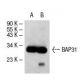 BAP31 Antibody (6D148) - Western Blotting - Image 34843