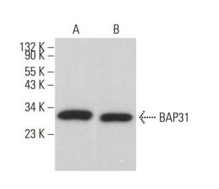 BAP31 Antibody (6D148) - Western Blotting - Image 378111 