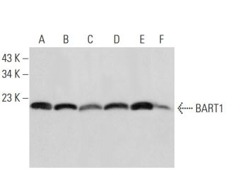 BART1 Antibody (6) - Western Blotting - Image 308696 