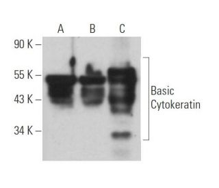 Basic Cytokeratin Antibody (3G129) - Western Blotting - Image 363890 