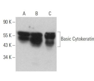 Basic Cytokeratin Antibody (AE3) - Western Blotting - Image 359291 