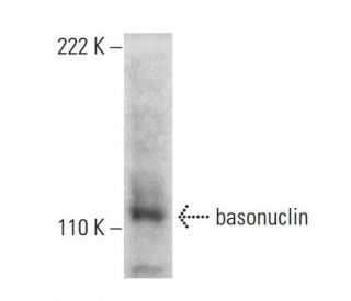 basonuclin Antibody (1F4) - Western Blotting - Image 384453Each CRISPR/Cas9 Knockout (KO) Plasmid product consists of a pool of 3 plasmids designed to ensure identification and cleavage of a specific gene for maximum knockout efficiency. Each plasmid encodes a unique 20 nt sequence derived from the GeCKO (v2) library.