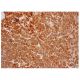 BBS1 Antibody (F-1) - Immunohistochemistry - Image 285742