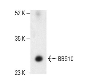 BBS10 Antibody (A-3) - Western Blotting - Image 404139