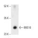 BBS10 Antibody (A-3) - Western Blotting - Image 404139