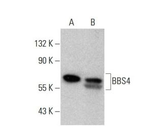 BBS4 Antibody (1292CT845.130.218) - Western Blotting - Image 376894The Double Nickase Plasmid features a U6 promoter for sgRNA expression, a 20 nt targeting sequence, and a gRNA scaffold to guide Cas9n. It includes a CBh promoter for Cas9n (D10A) and puromycin resistance, GFP for transfection verification, and nuclear localization signals (NLS). The 2A peptide allows co-expression of Cas9n and Puro from a single promoter, enabling precise genome editing with reduced off-target effects.