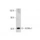 BC sub 3H1 Cell Lysate: sc-2299. Western blot analysis of AChR alpha 1 expression...