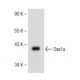 BC sub 3H1 Cell Lysate: sc-2299. Western blot analysis of Oas1a expression... 