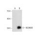 BCDIN3D Antibody (F-5) - Western Blotting - Image 287820 