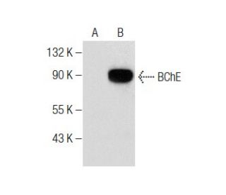 BChE Antibody (D-5) - Western Blotting - Image 284397The Double Nickase Plasmid features a U6 promoter for sgRNA expression, a 20 nt targeting sequence, and a gRNA scaffold to guide Cas9n. It includes a CBh promoter for Cas9n (D10A) and puromycin resistance, GFP for transfection verification, and nuclear localization signals (NLS). The 2A peptide allows co-expression of Cas9n and Puro from a single promoter, enabling precise genome editing with reduced off-target effects. 