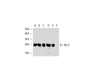 Bcl-2 Antibody (100) - Western Blotting - Image 1681 