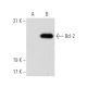 Bcl-2 Antibody (5K140) - Western Blotting - Image 51264