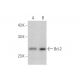 Bcl-2 Antibody (5K140) - Western Blotting - Image 352819 