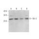 Bcl-2 Antibody (5K140) - Western Blotting - Image 377565 