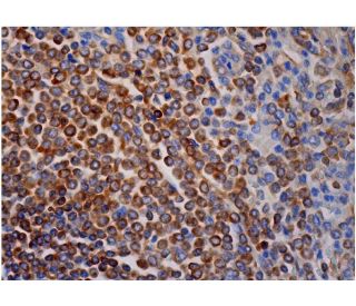 Bcl-2 Antibody (8C8) - Immunohistochemistry - Image 286485 