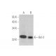 Bcl-2 Antibody (YTH10C4) - Western Blotting - Image 352816