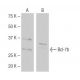 Bcl-7b Antibody (NQ-B25) - Western Blotting - Image 64867