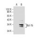 Bcl-7b Antibody (NQ-B25) - Western Blotting - Image 154548 