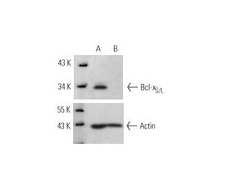 Bcl-x<sub>S/L</sub> siRNA (h): sc-29216. Western blot analysis of Bcl-x<sub>S/L</sub> expression in non-transfected contro 
