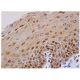 Bcr Antibody (7C6) - Immunohistochemistry - Image 355433