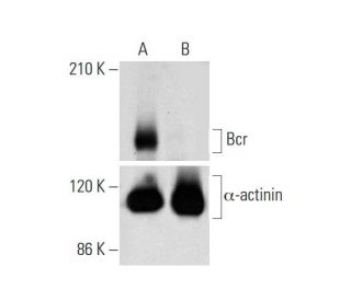Bcr HDR Plasmid (h): sc-401514-HDR. Western blot analysis of Bcr expression in non-transfected control (A) and puromycin, 
