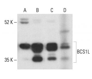 BCS1L Antibody (SS-M13) - Western Blotting - Image 401920 