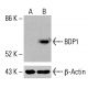 BDP1(B-6)抗体:sc-515058。通过蛋白质印迹分析未处理(A)和化学处理(B)的HeLa完整细胞裂解物中BDP1的表达。使用的检测试剂:m-IgGλ BP-HRP:sc-516132。β-肌动蛋白(C4):sc-47778,用作加载对照。使用的检测试剂:m-IgG Fc BP-HRP:sc-525409。 BDP1 Antibody (B-6) - Western Blotting - Image 415867