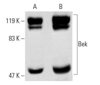 Bek/FGFR2 Antibody (C-8) - Western Blotting - Image 2799 