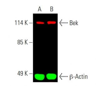 Bek/FGFR2 Antibody (C-8) - Western Blotting - Image 388236Each CRISPR/Cas9 Knockout (KO) Plasmid product consists of a pool of 3 plasmids designed to ensure identification and cleavage of a specific gene for maximum knockout efficiency. Each plasmid encodes a unique 20 nt sequence derived from the GeCKO (v2) library.