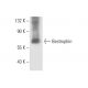 Bestrophin Antibody (E6-6) - Western Blotting - Image 10094