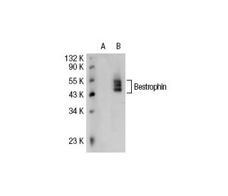 Bestrophin Antibody (E6-6) - Western Blotting - Image 30901 