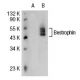 Bestrophin Antibody (E6-6) - Western Blotting - Image 30901 
