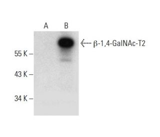 &beta;-1,4-GalNAc-T2 Antibody (G-1) - Western Blotting - Image 294809
