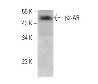 beta 2 Adrenergic Receptor/ADRB2/β2-AR Antibody (E-3) - Western Blotting - Image 379893SAM Transcription Activation: SAM system utilizing dCas9-VP64, MS2-P65-HSF1, and sgRNA for precise gene transcription activation.