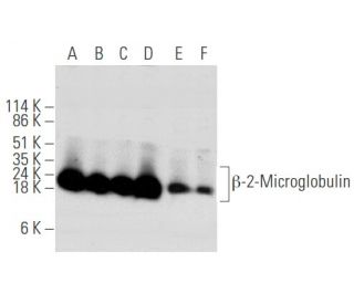 &beta;-2-Microglobulin Antibody (G-10) - Western Blotting - Image 354765 