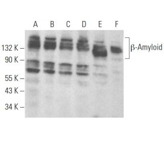 &beta;-Amyloid Antibody (20.1) - Western Blotting - Image 354514 