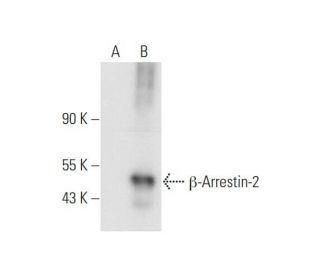 &beta;-Arrestin-2 Antibody (F-2) - Western Blotting - Image 332785