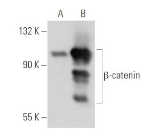 beta-catenin Antibody (10H8) - Western Blotting - Image 34790 