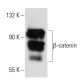 beta-catenin Antibody (10H8) - Western Blotting - Image 34754