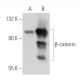 beta-catenin Antibody (10H8) - Western Blotting - Image 34790 