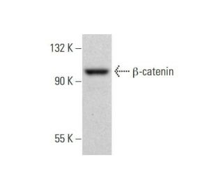 beta-catenin Antibody (12F7) - Western Blotting - Image 353134 