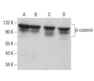 beta-catenin Antibody (15B8) - Western Blotting - Image 383734 