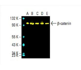beta-catenin Antibody (15B8) - Western Blotting - Image 393701